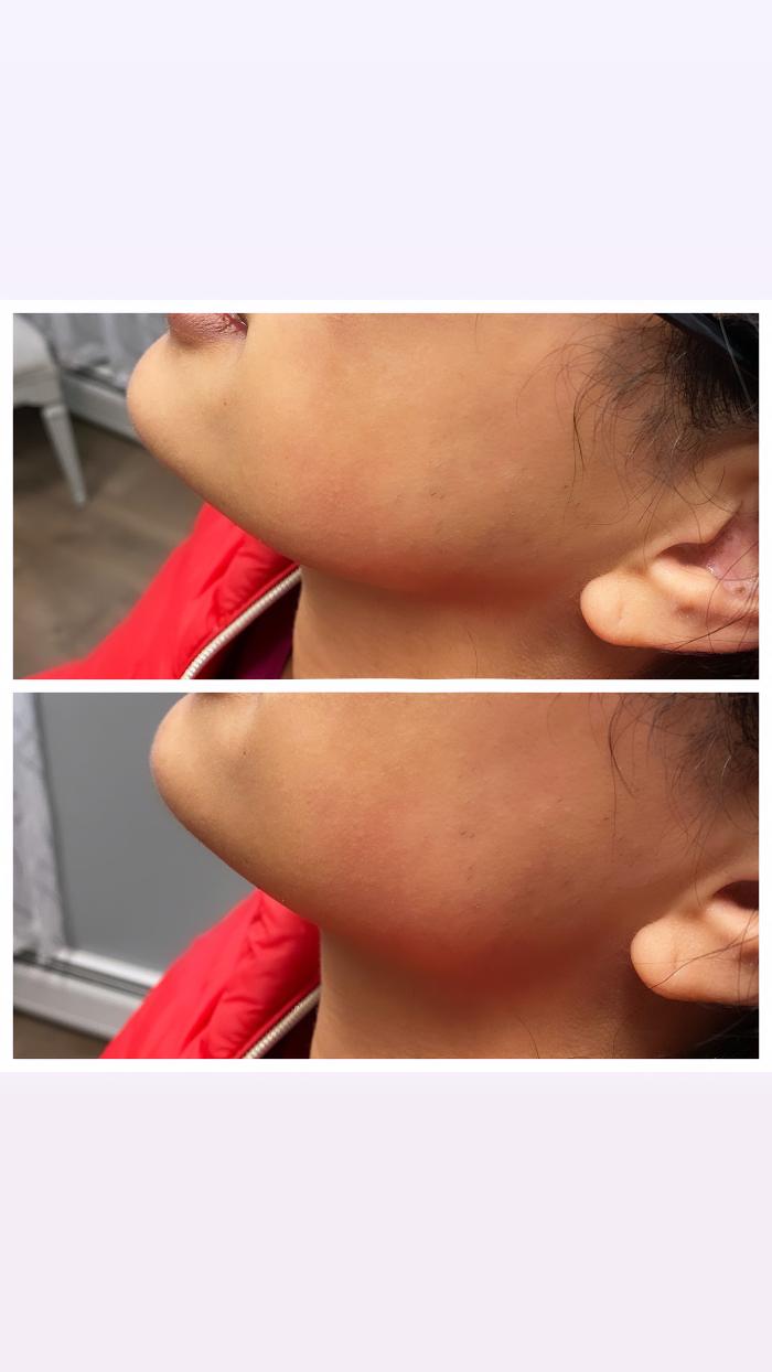 Blush Med Spa - Enfield, CT