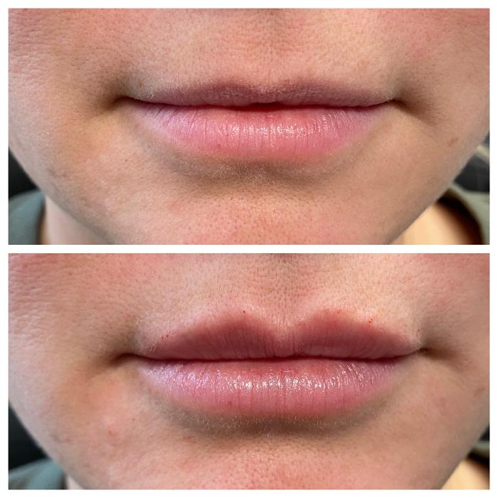 Blush Med Spa - Enfield, CT