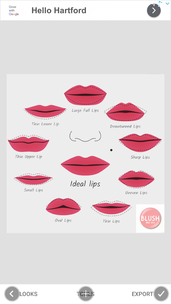 Blush Med Spa - Enfield, CT