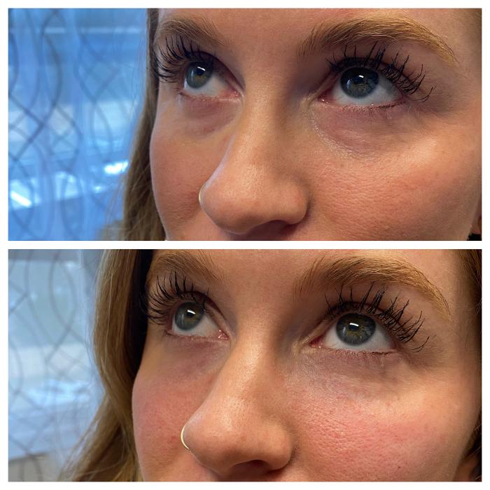 Blush Med Spa - Enfield, CT