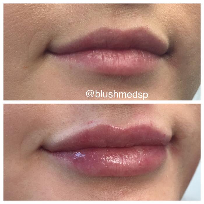 Blush Med Spa - Enfield, CT