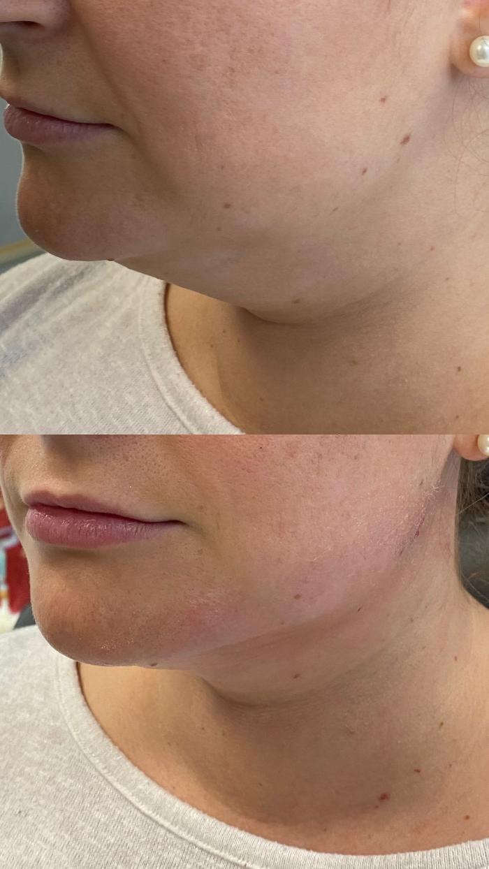 Blush Med Spa - Enfield, CT