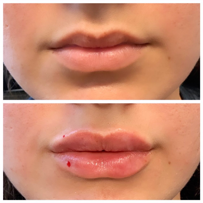 Blush Med Spa - Enfield, CT