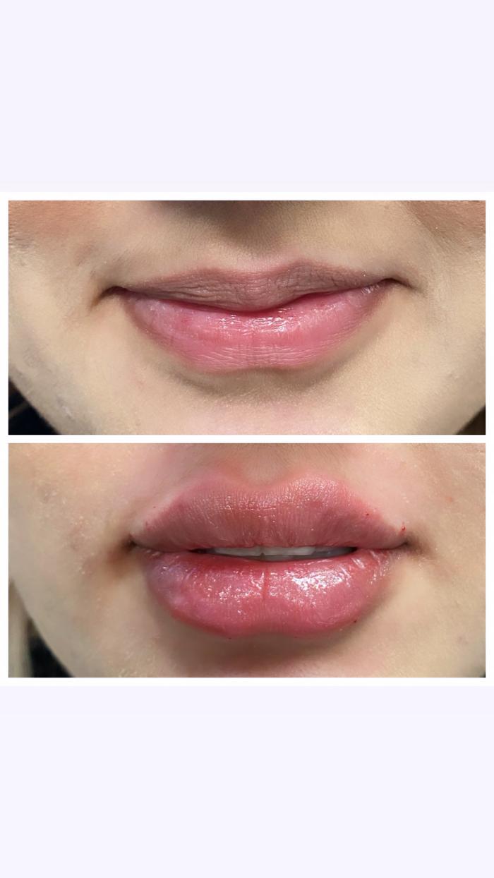 Blush Med Spa - Enfield, CT