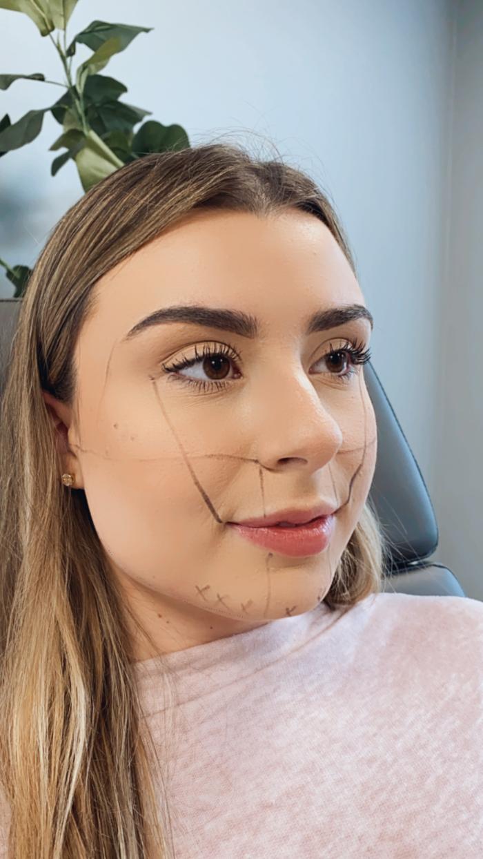 Blush Med Spa - Enfield, CT