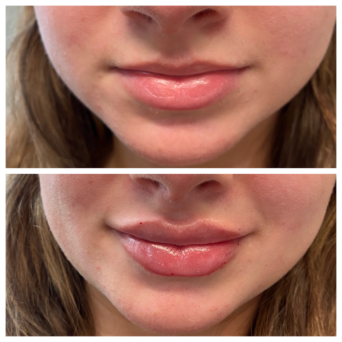 Blush Med Spa - Enfield, CT