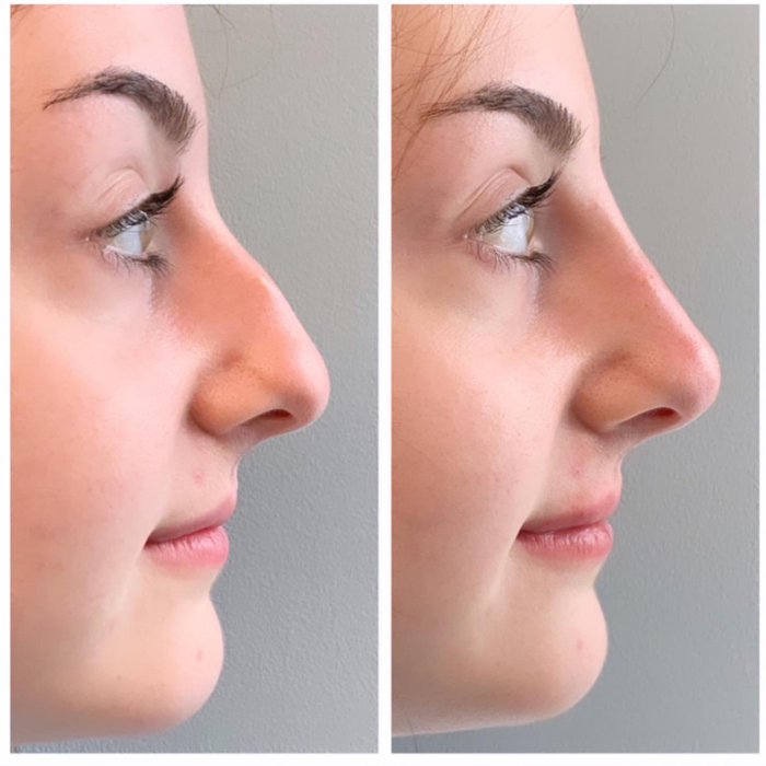 Blush Med Spa - Enfield, CT