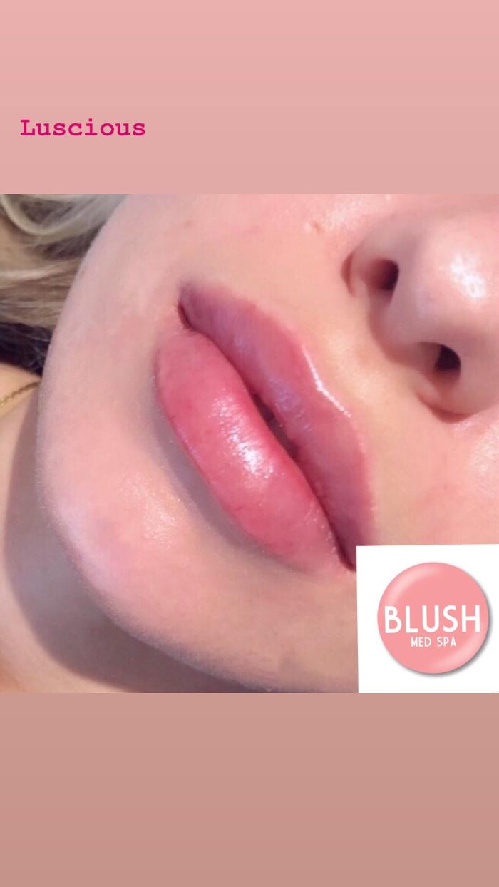 Blush Med Spa - Enfield, CT