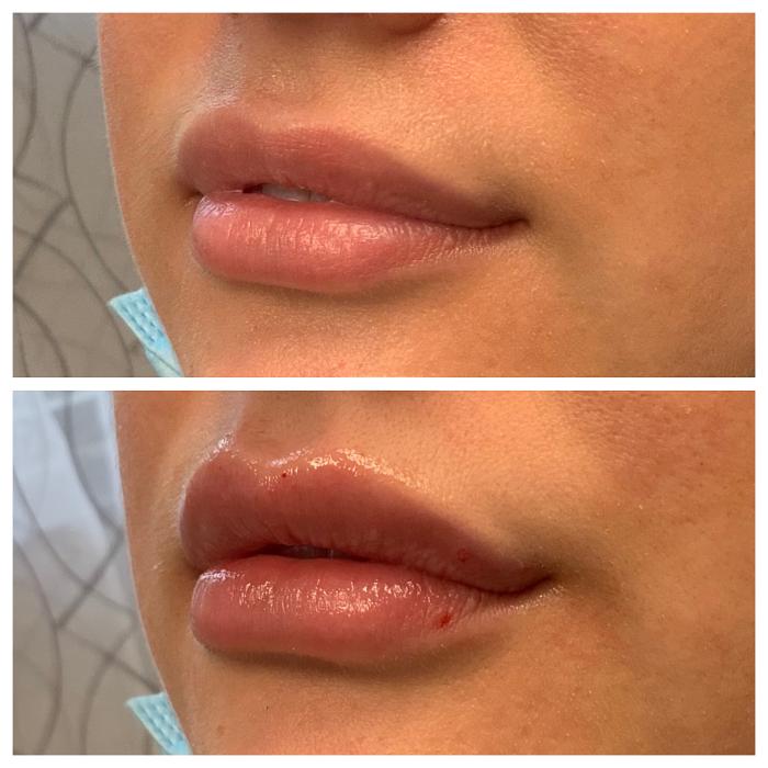 Blush Med Spa - Enfield, CT