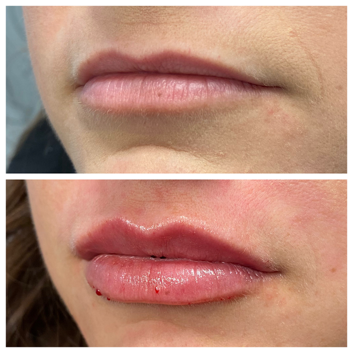 Blush Med Spa - Enfield, CT