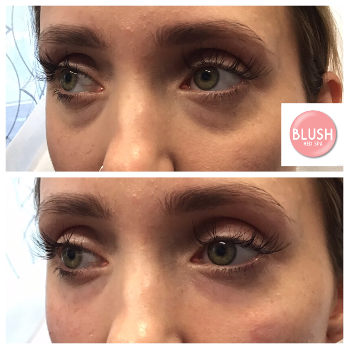 Blush Med Spa - Enfield, CT