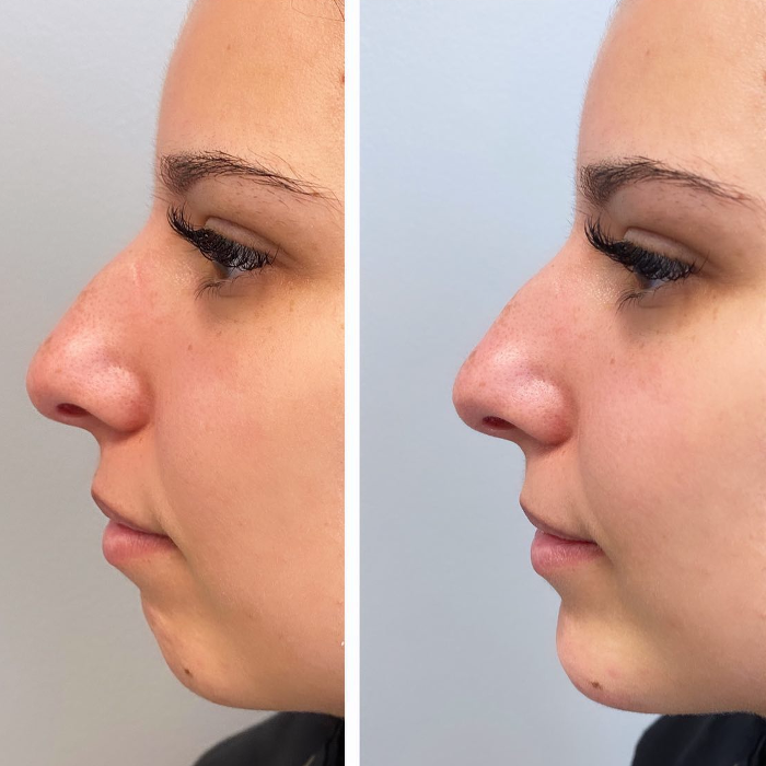 Blush Med Spa - Enfield, CT