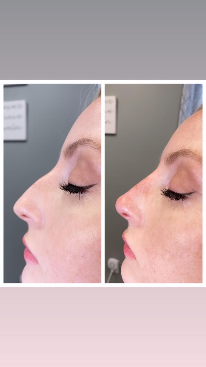 Blush Med Spa - Enfield, CT