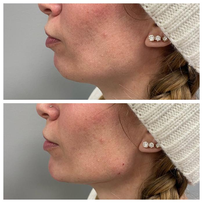 Blush Med Spa - Enfield, CT