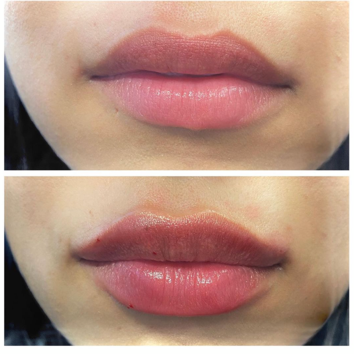 Blush Med Spa - Enfield, CT