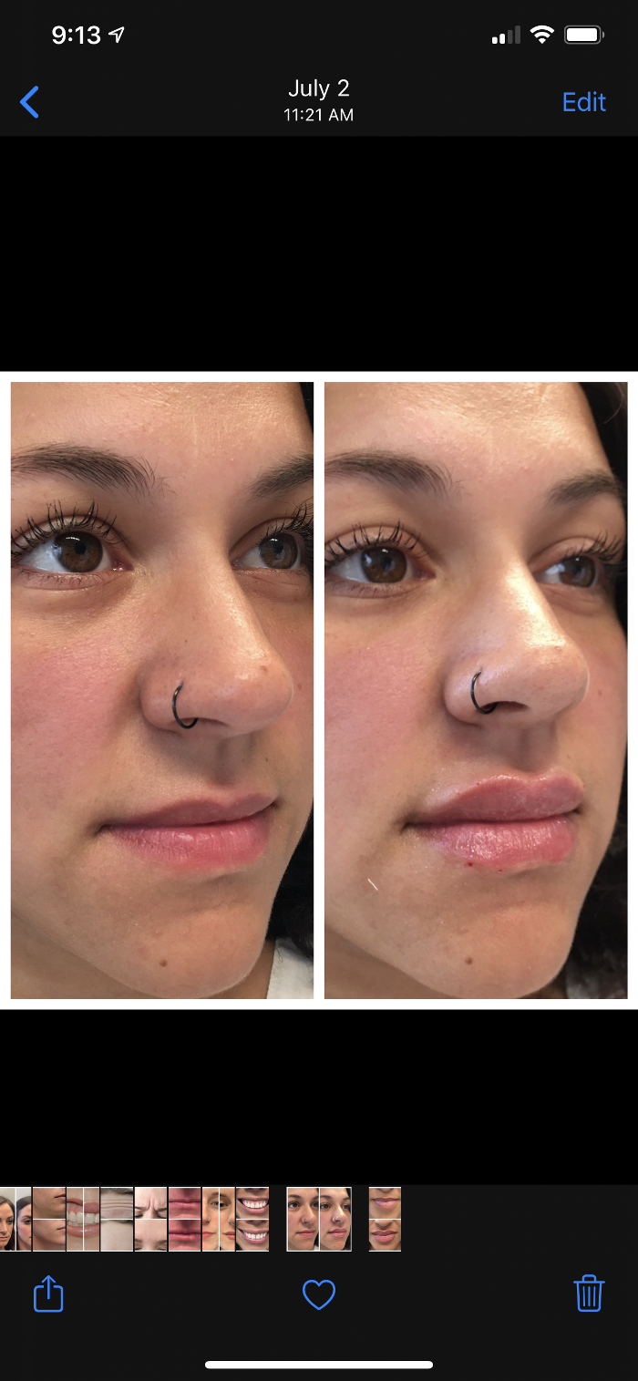 Blush Med Spa - Enfield, CT