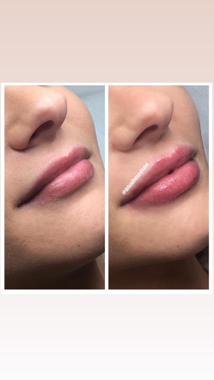 Blush Med Spa - Enfield, CT