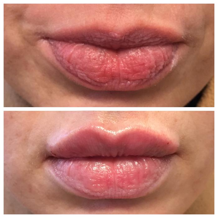 Blush Med Spa - Enfield, CT