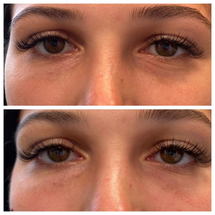 Blush Med Spa - Enfield, CT