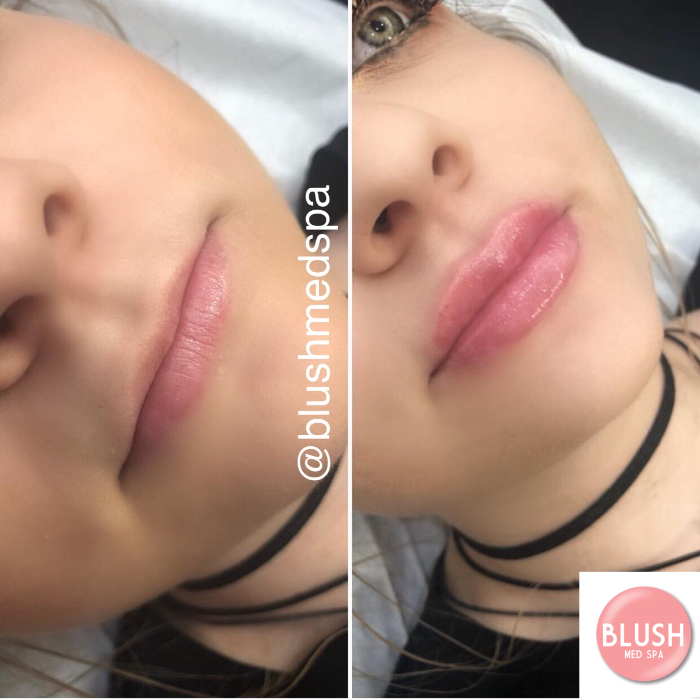 Blush Med Spa - Enfield, CT