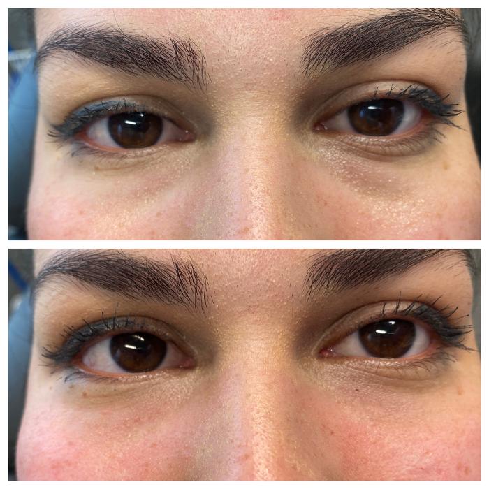 Blush Med Spa - Enfield, CT