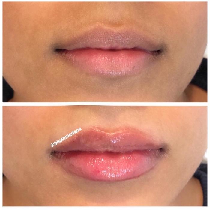 Blush Med Spa - Enfield, CT