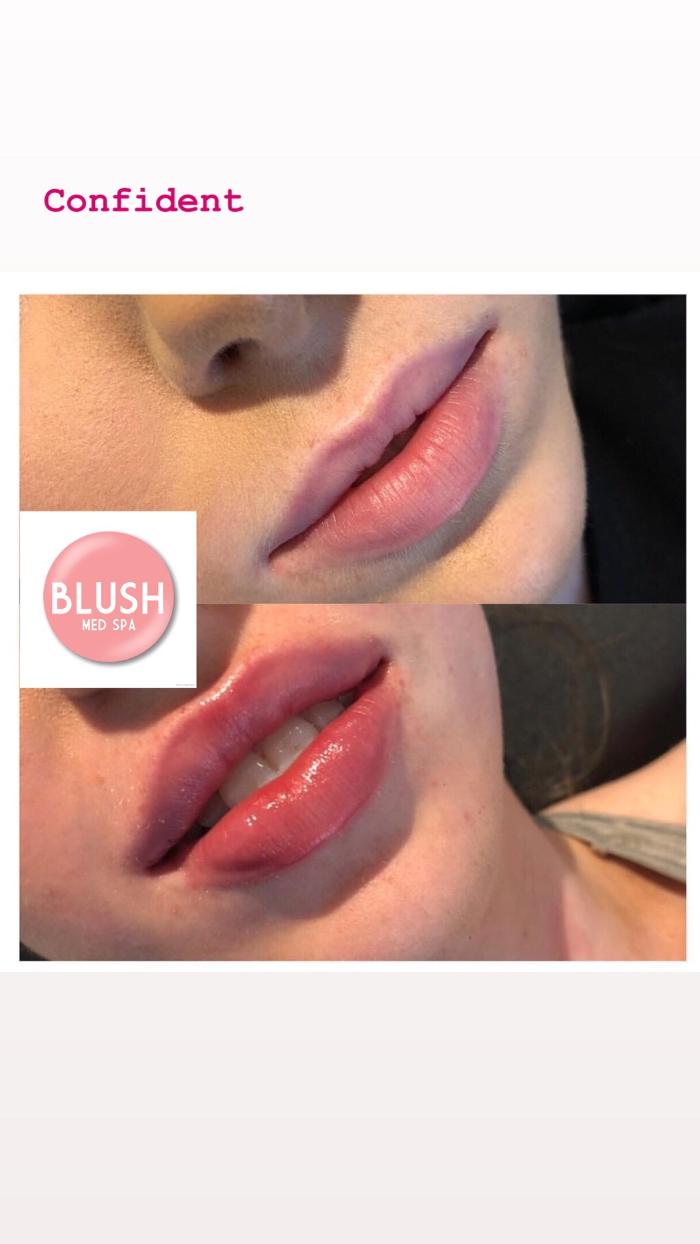 Blush Med Spa - Enfield, CT