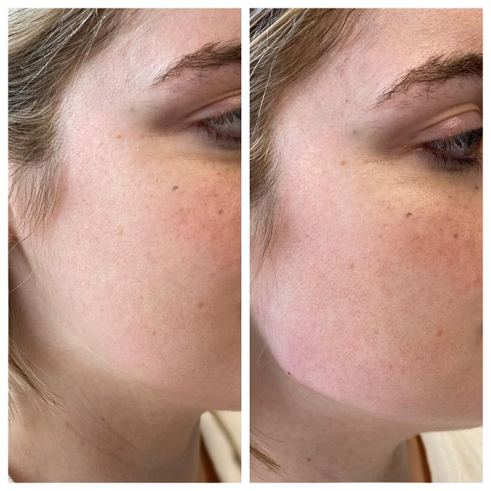 Blush Med Spa - Enfield, CT