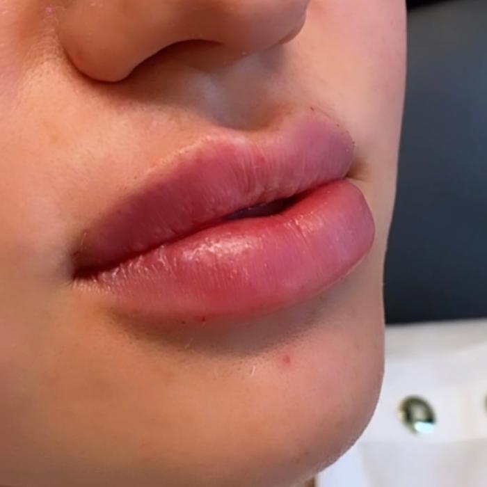 Blush Med Spa - Enfield, CT