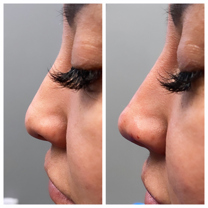 Blush Med Spa - Enfield, CT