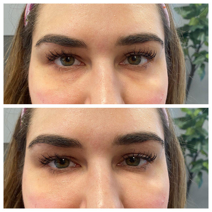 Blush Med Spa - Enfield, CT