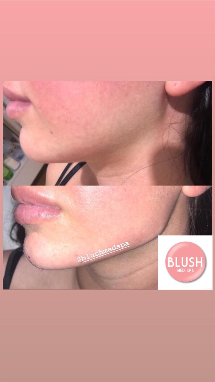 Blush Med Spa - Enfield, CT