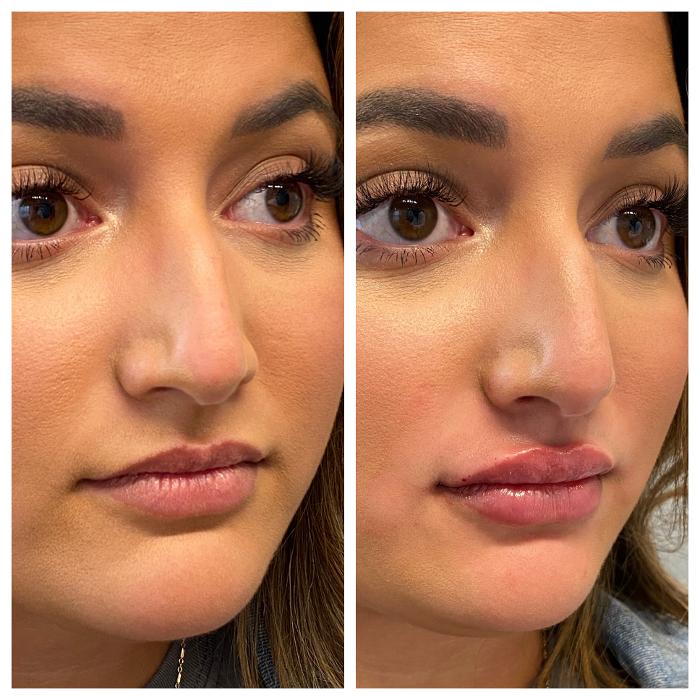 Blush Med Spa - Enfield, CT