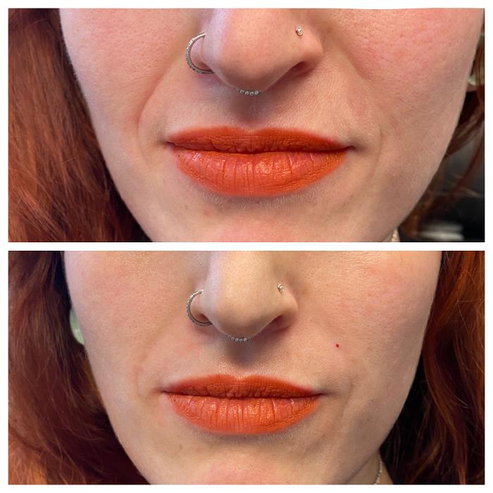 Blush Med Spa - Enfield, CT