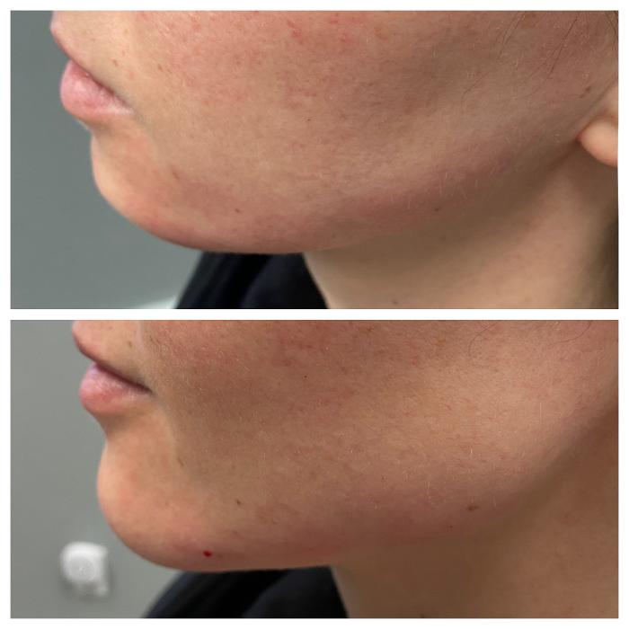 Blush Med Spa - Enfield, CT