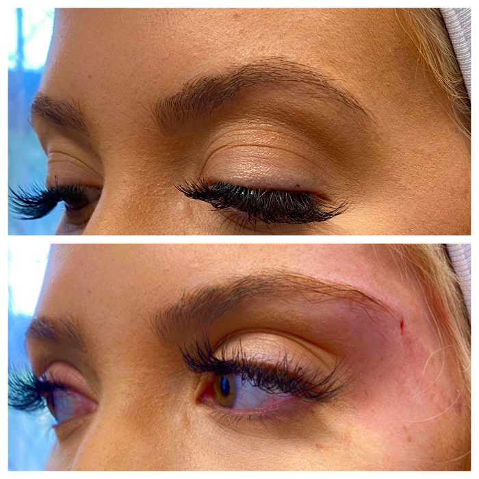 Blush Med Spa - Enfield, CT