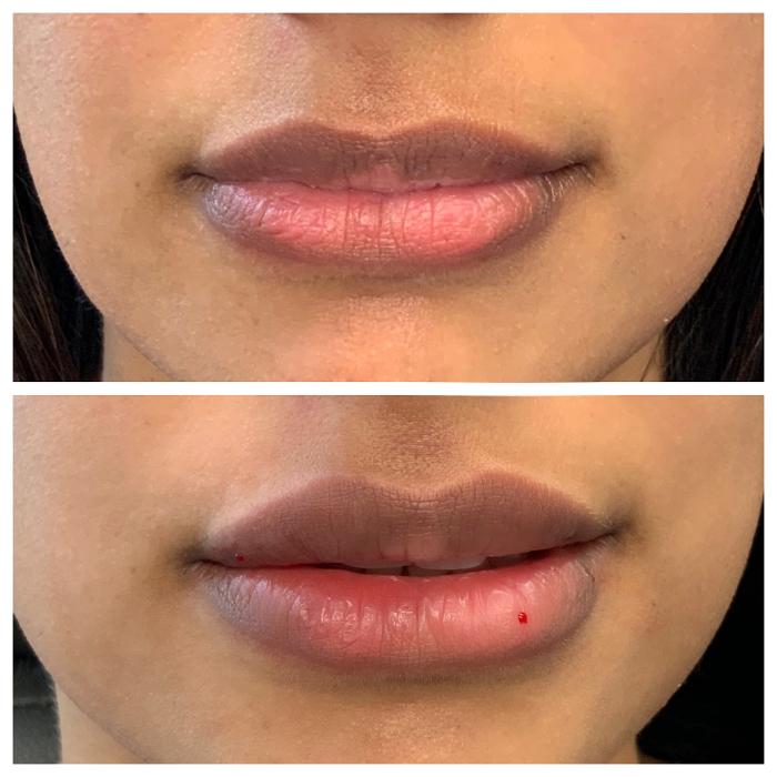 Blush Med Spa - Enfield, CT