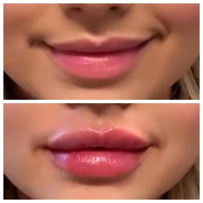 Blush Med Spa - Enfield, CT