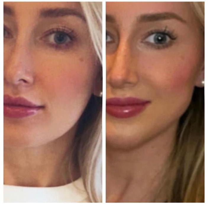 Blush Med Spa - Enfield, CT