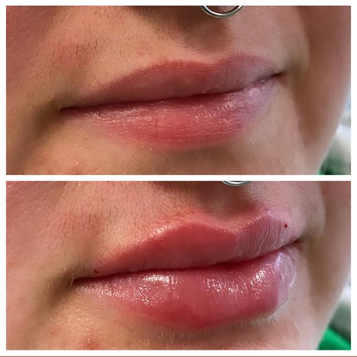 Blush Med Spa - Enfield, CT