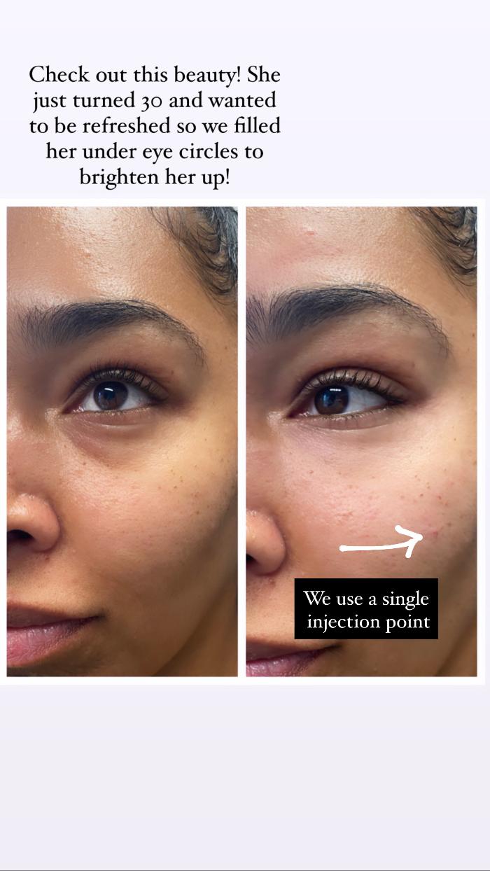 Blush Med Spa - Enfield, CT