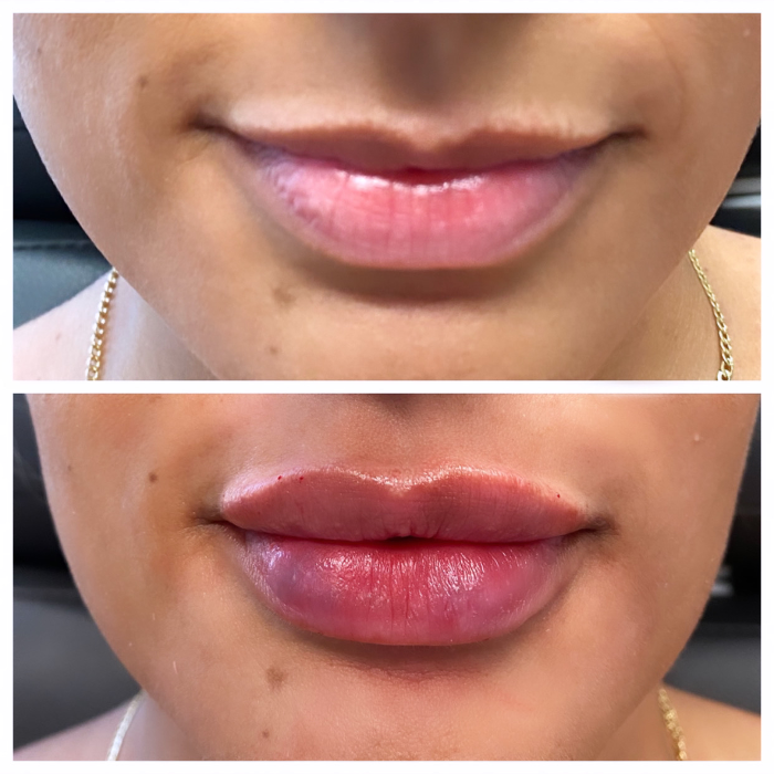 Blush Med Spa - Enfield, CT