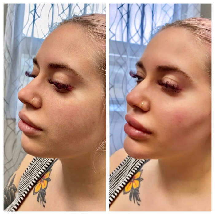 Blush Med Spa - Enfield, CT