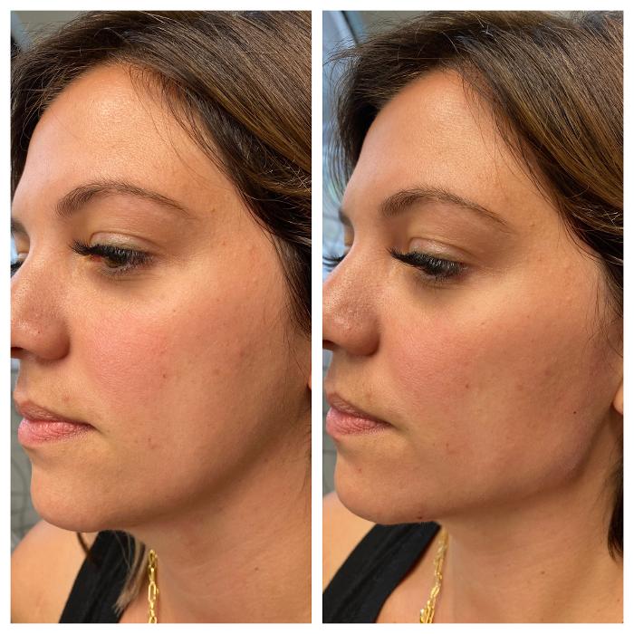 Blush Med Spa - Enfield, CT