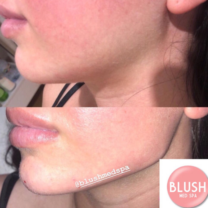 Blush Med Spa - Enfield, CT