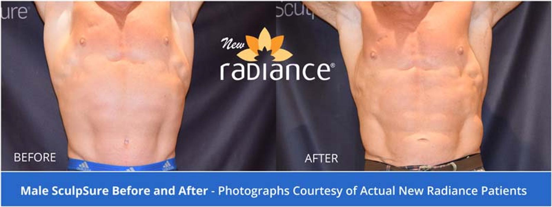 New Radiance Cosmetic Centers - Palm Beach Gardens, FL