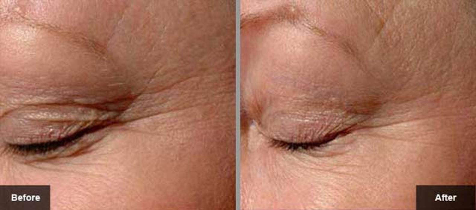 New Radiance Cosmetic Centers - Palm Beach Gardens, FL