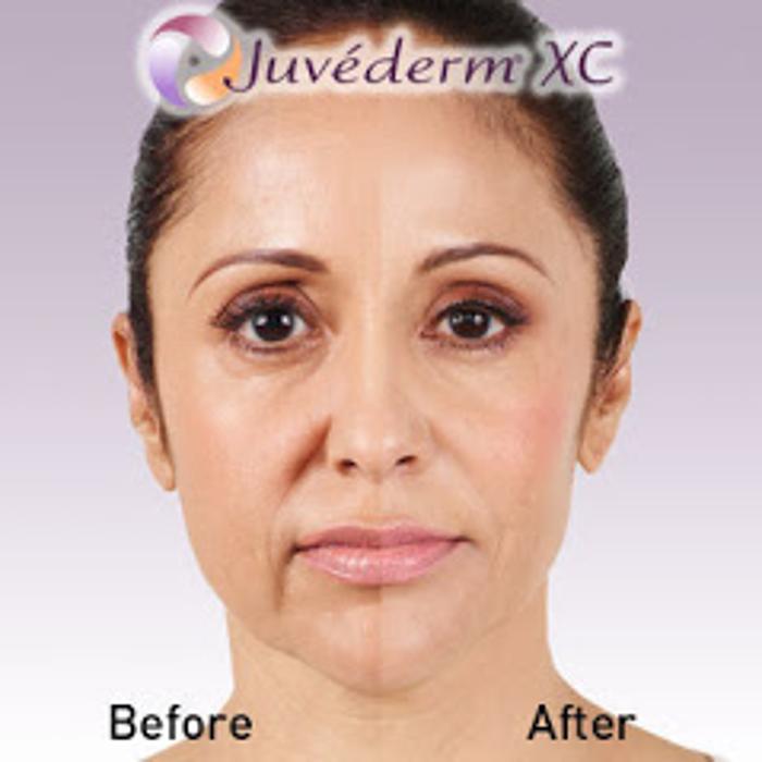 New Radiance Cosmetic Centers - Palm Beach Gardens, FL