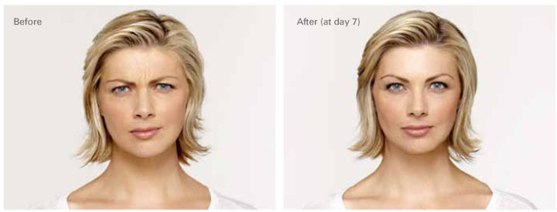 New Radiance Cosmetic Centers - Palm Beach Gardens, FL