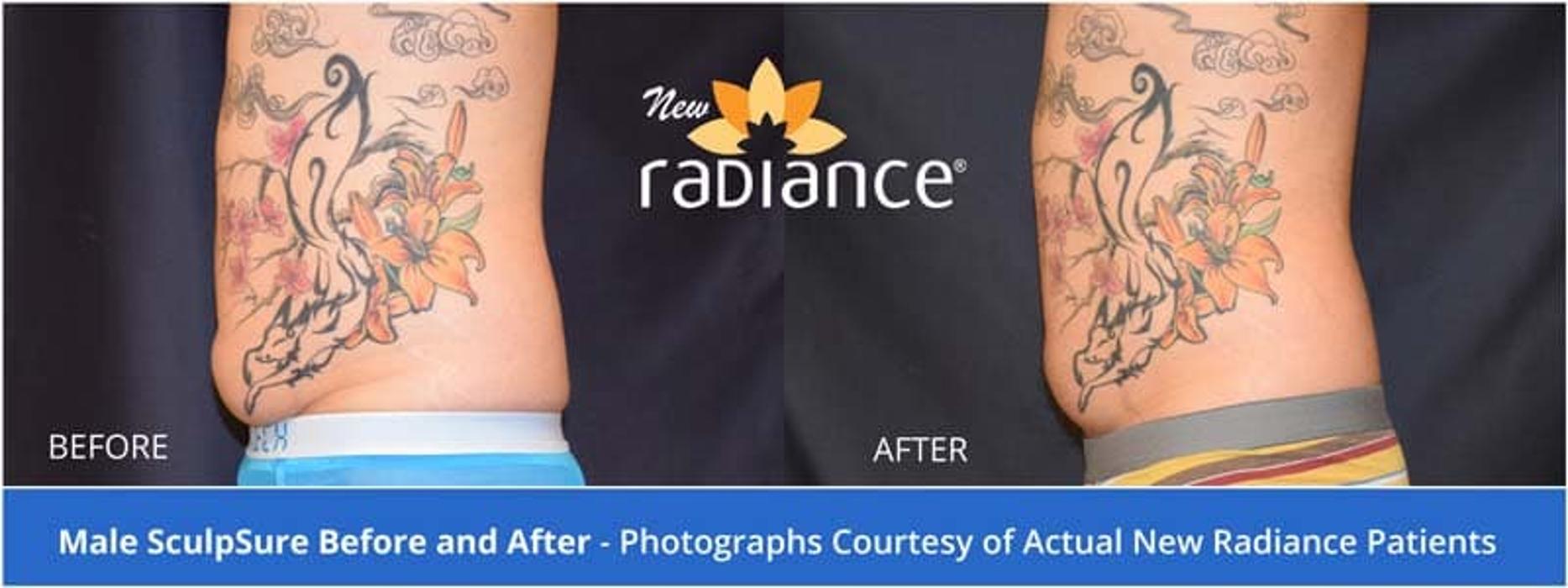 New Radiance Cosmetic Centers - Palm Beach Gardens, FL